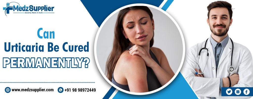 Can Urticaria Be Cured Permanently