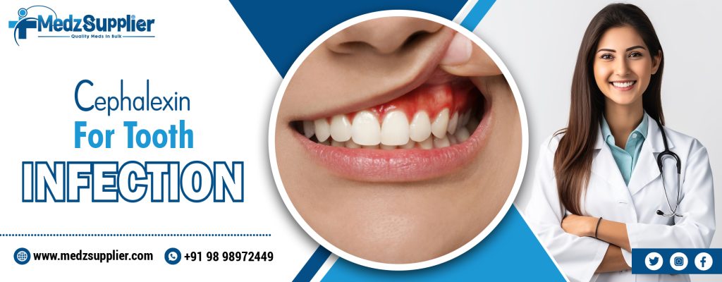 Cephalexin for Tooth Infection 1 Cephalexin For Tooth Infection
