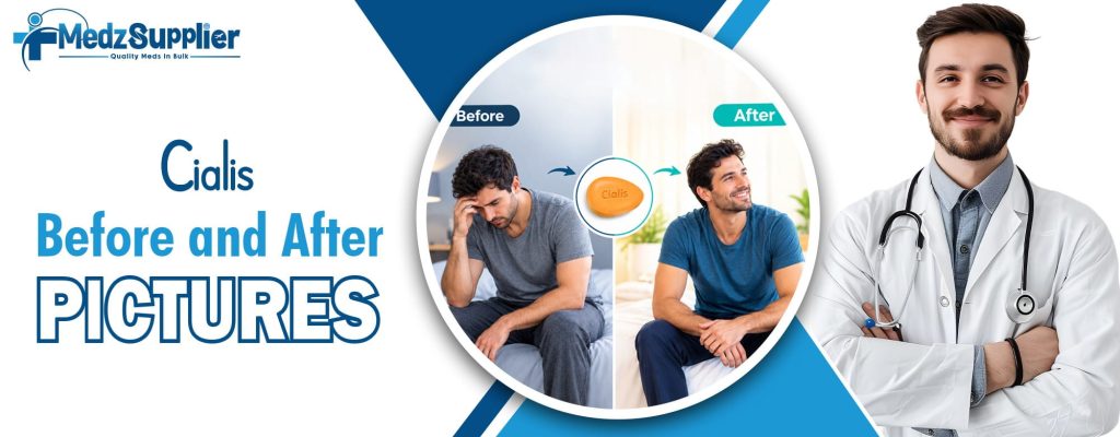 Cialis Before and After Pictures