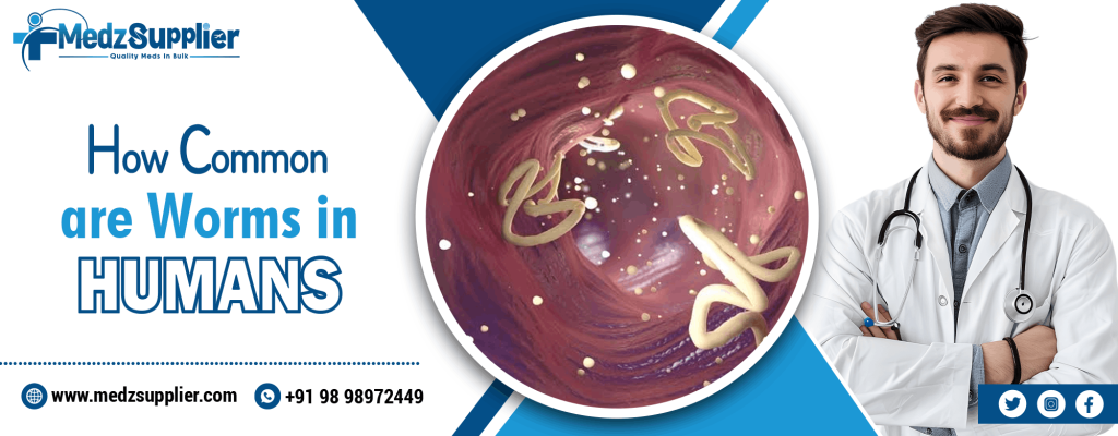 How Common are Worms in Humans 1 How Common are Worms in Humans